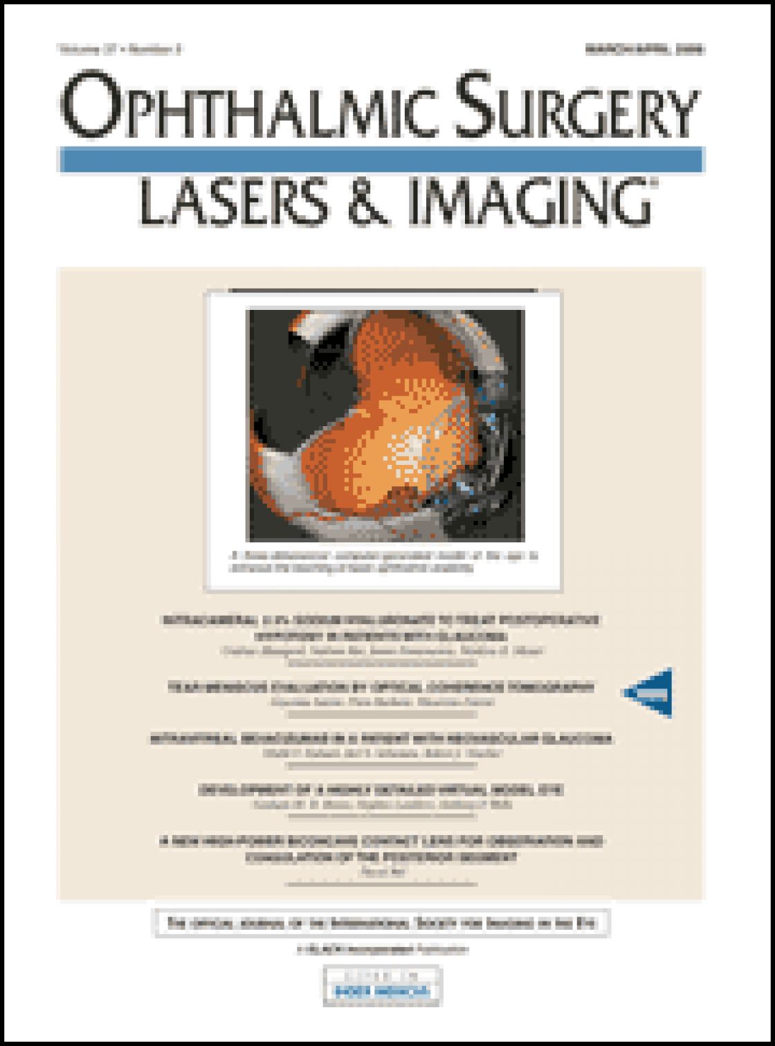 Tear meniscus evaluation by optical coherence tomography