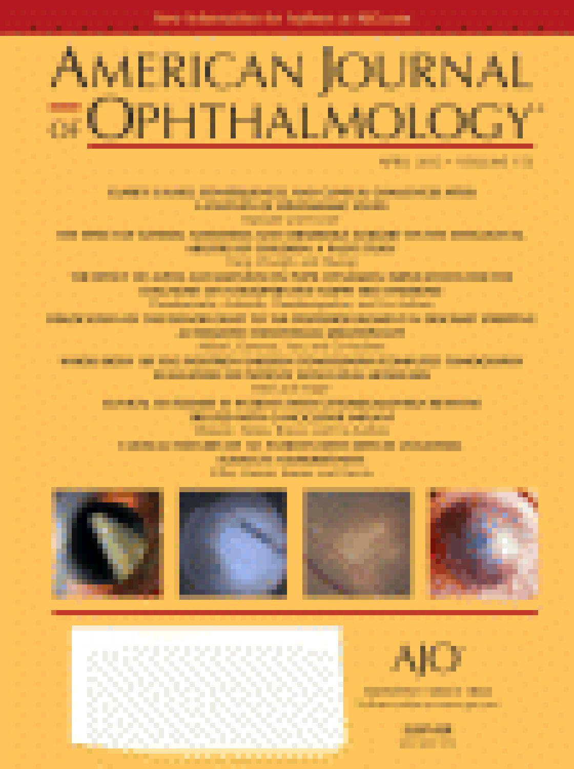 Evaluation of the nerve fiber layer and macula in the eyes of healthy children using spectral-domain optical coherence tomography