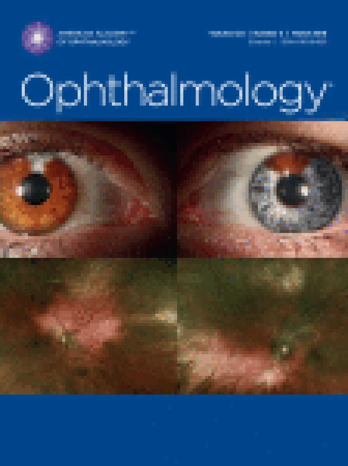 Measurement of central corneal thickness with optical low-coherence reflectometry and ultrasound pachymetry in normal and post-femtosecond laser in situ keratomileusis eyes