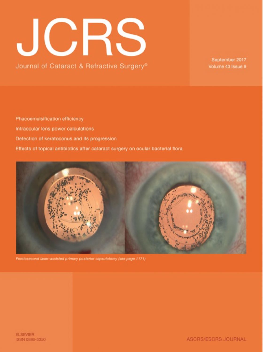 Measurement of central corneal thickness with optical low-coherence reflectometry and ultrasound pachymetry in normal and post-femtosecond laser in situ keratomileusis eyes