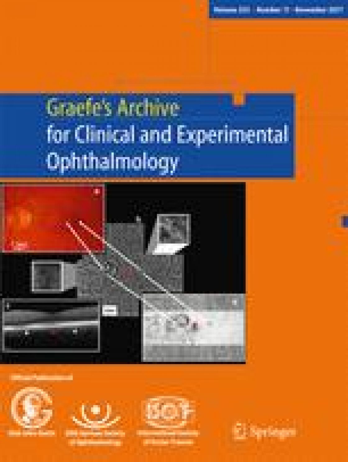 Measurement of central corneal thickness with optical low-coherence reflectometry and ultrasound pachymetry in normal and post-femtosecond laser in situ keratomileusis eyes