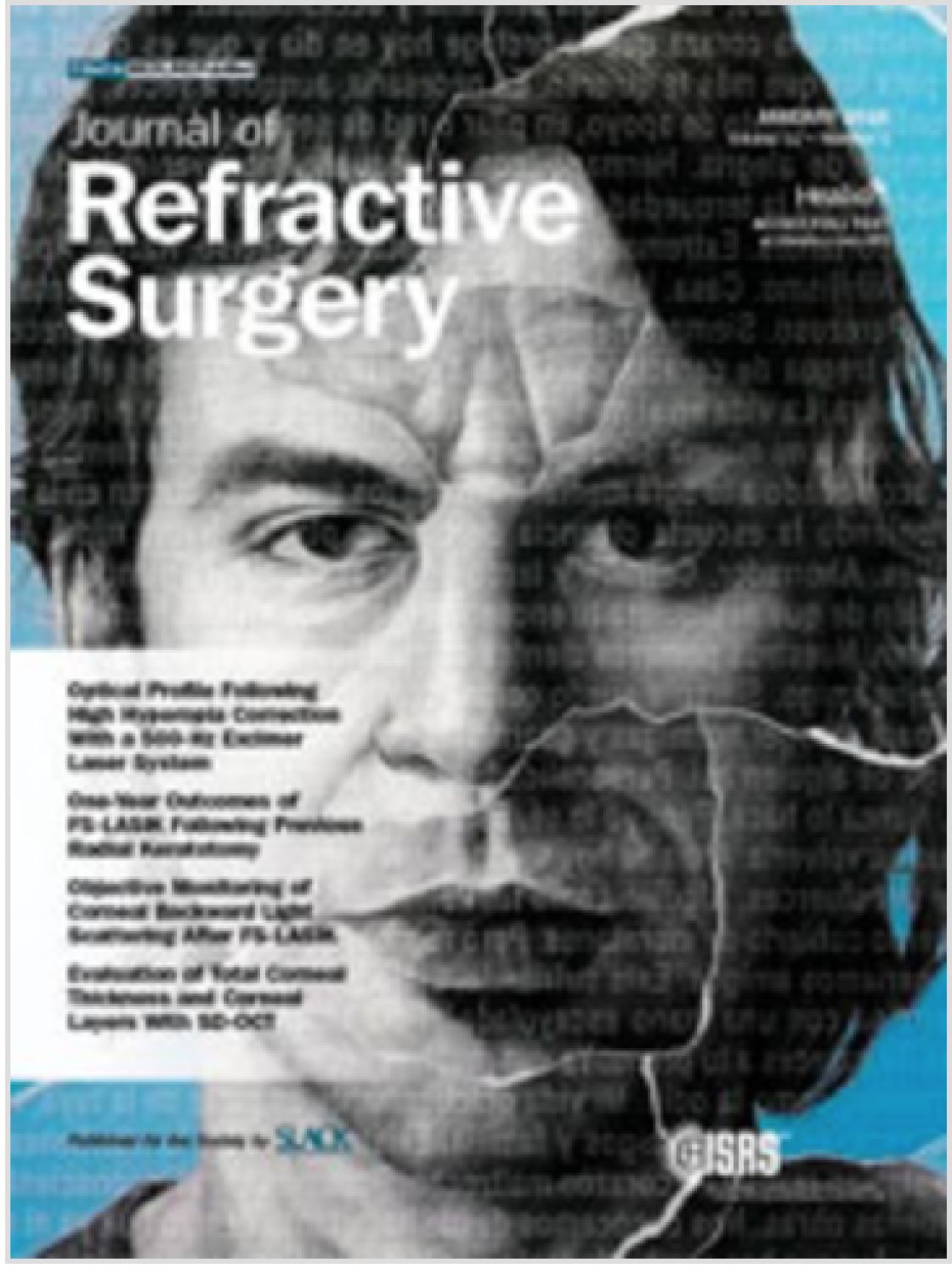 Measurement of central corneal thickness with optical low-coherence reflectometry and ultrasound pachymetry in normal and post-femtosecond laser in situ keratomileusis eyes