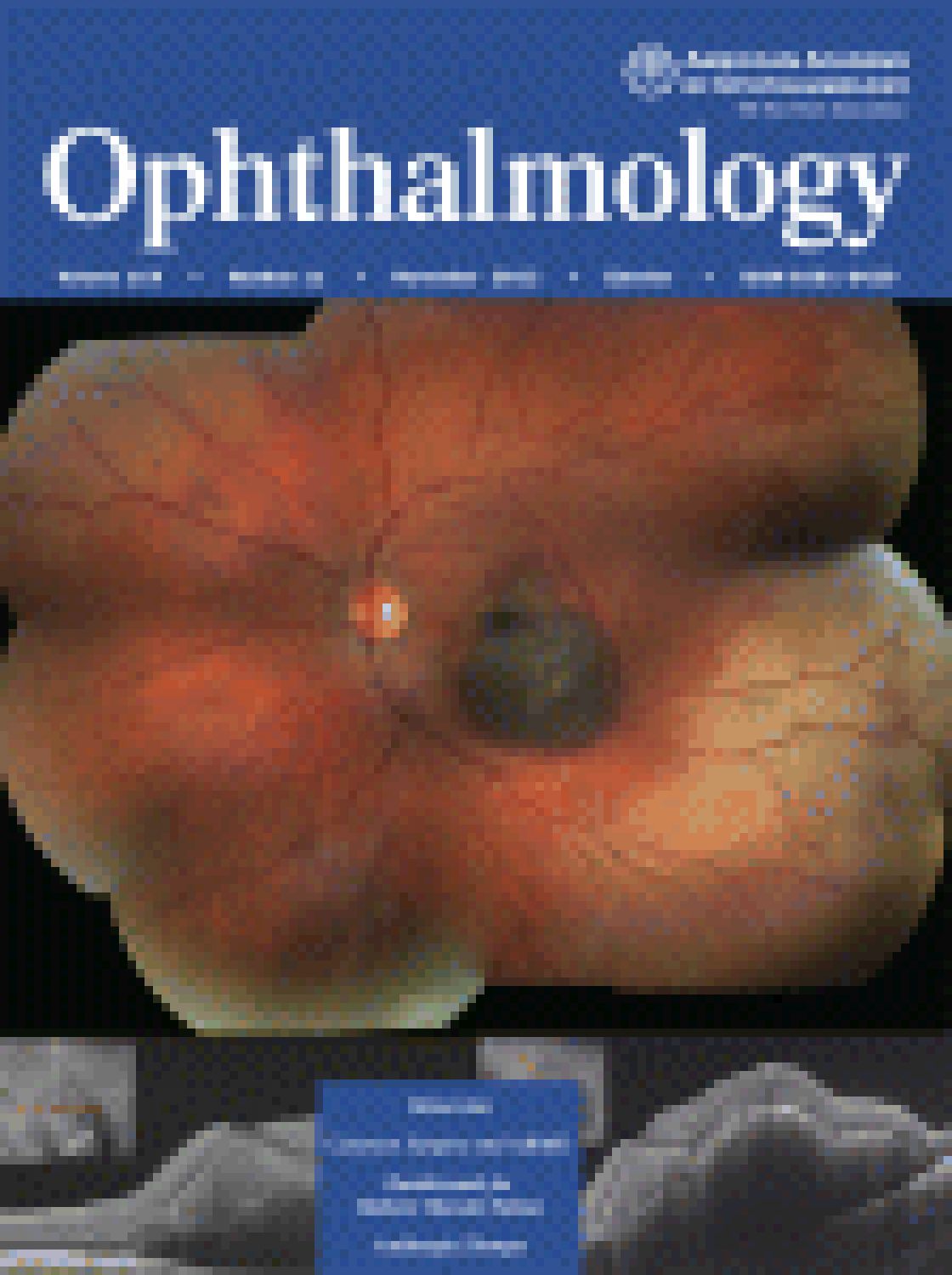 Use of a support vector machine for keratoconus and subclinical keratoconus detection by topographic and tomographic data