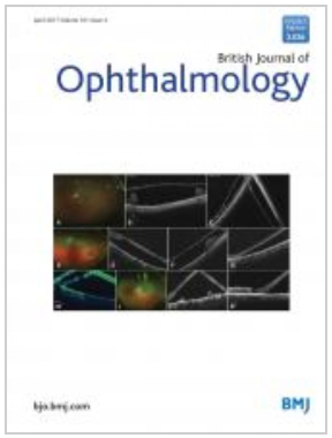 Measurement of central corneal thickness with optical low-coherence reflectometry and ultrasound pachymetry in normal and post-femtosecond laser in situ keratomileusis eyes