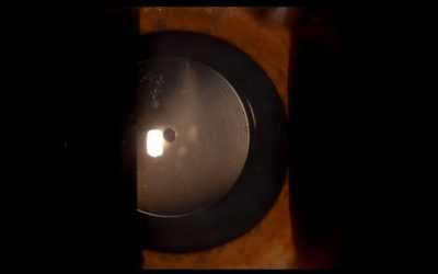 Novità in chirurgia refrattiva: lenti fachiche (ICL) e lenti intraoculari multifocali