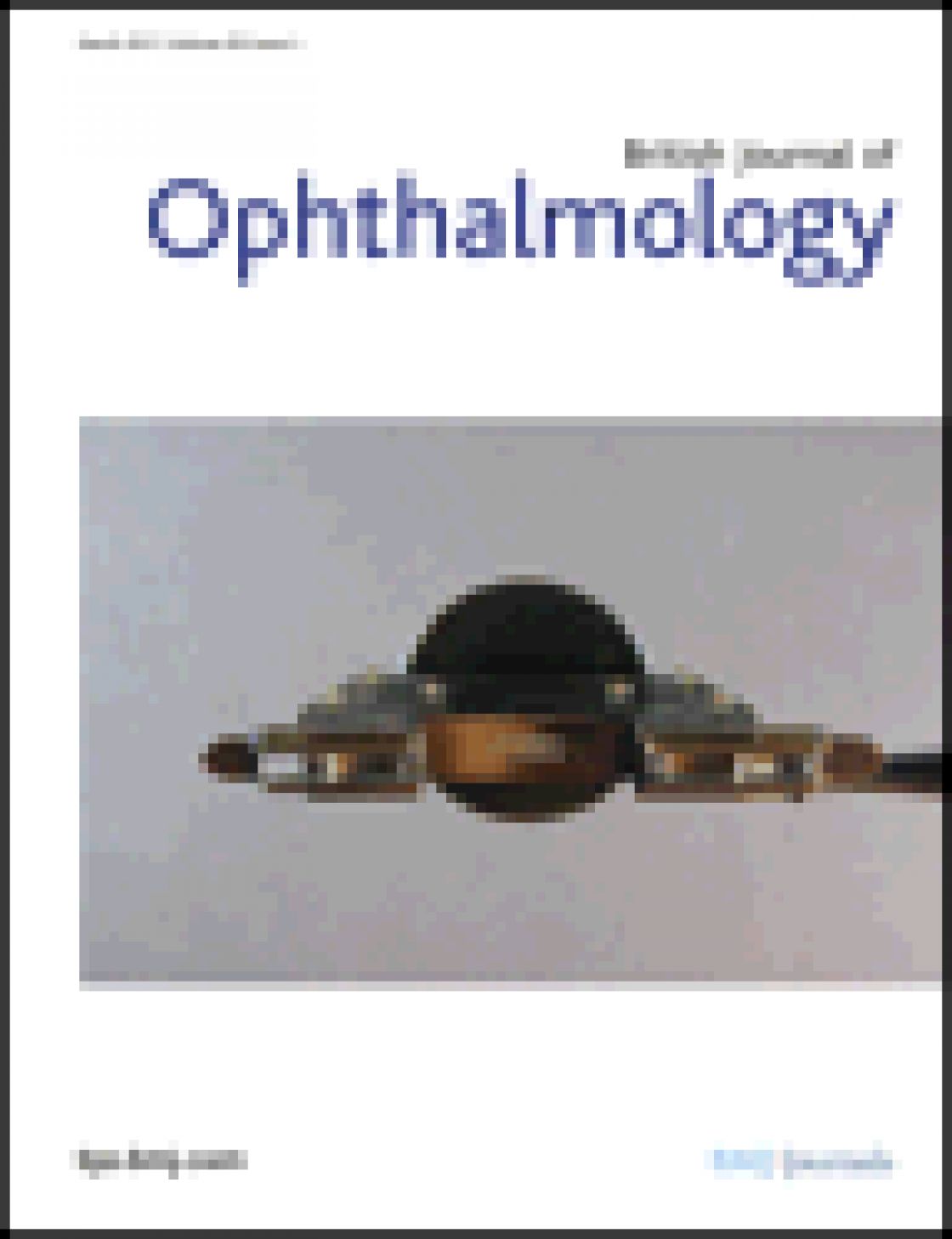 Cataract surgery in posterior polymorphous corneal dystrophy