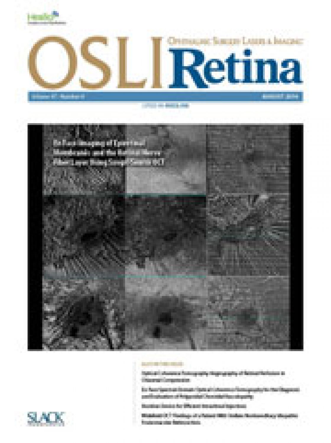 Measurement of central corneal thickness with optical low-coherence reflectometry and ultrasound pachymetry in normal and post-femtosecond laser in situ keratomileusis eyes