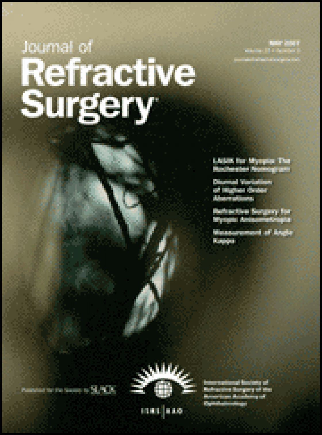 Correlation between attempted correction and keratometric index of the cornea after myopic excimer laser surgery