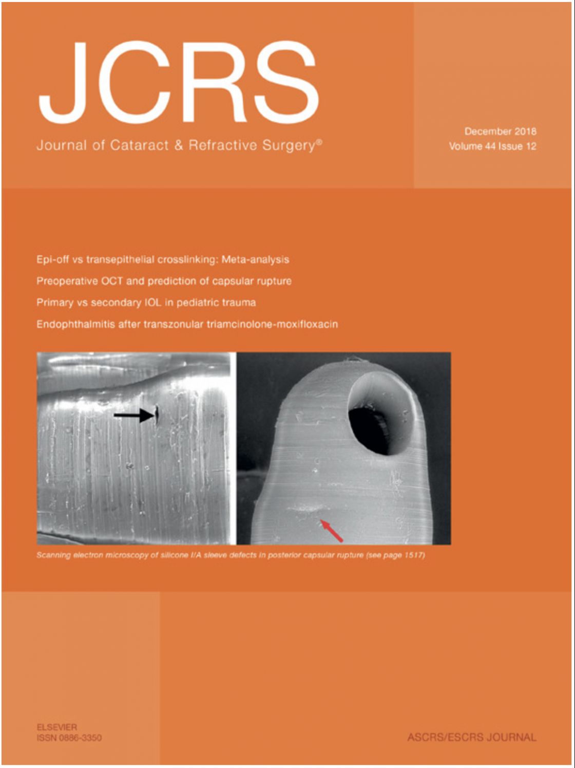 Measurement of central corneal thickness with optical low-coherence reflectometry and ultrasound pachymetry in normal and post-femtosecond laser in situ keratomileusis eyes