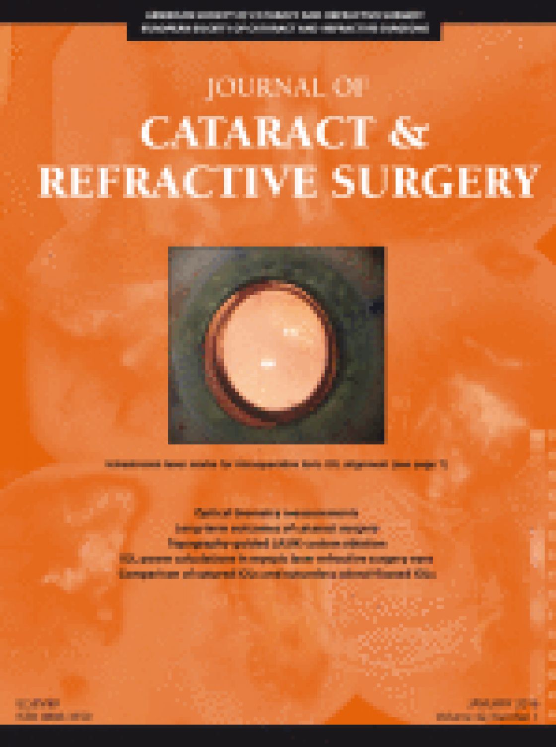 Measurement of central corneal thickness with optical low-coherence reflectometry and ultrasound pachymetry in normal and post-femtosecond laser in situ keratomileusis eyes