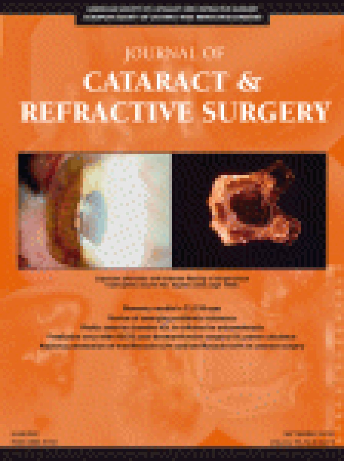 Intraocular lens power calculation after myopic excimer laser surgery: clinical comparison of published methods
