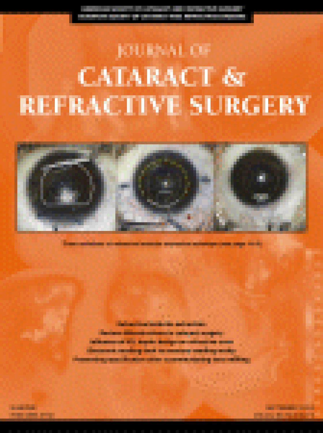 The influence of intraocular lens haptic design on refractive error