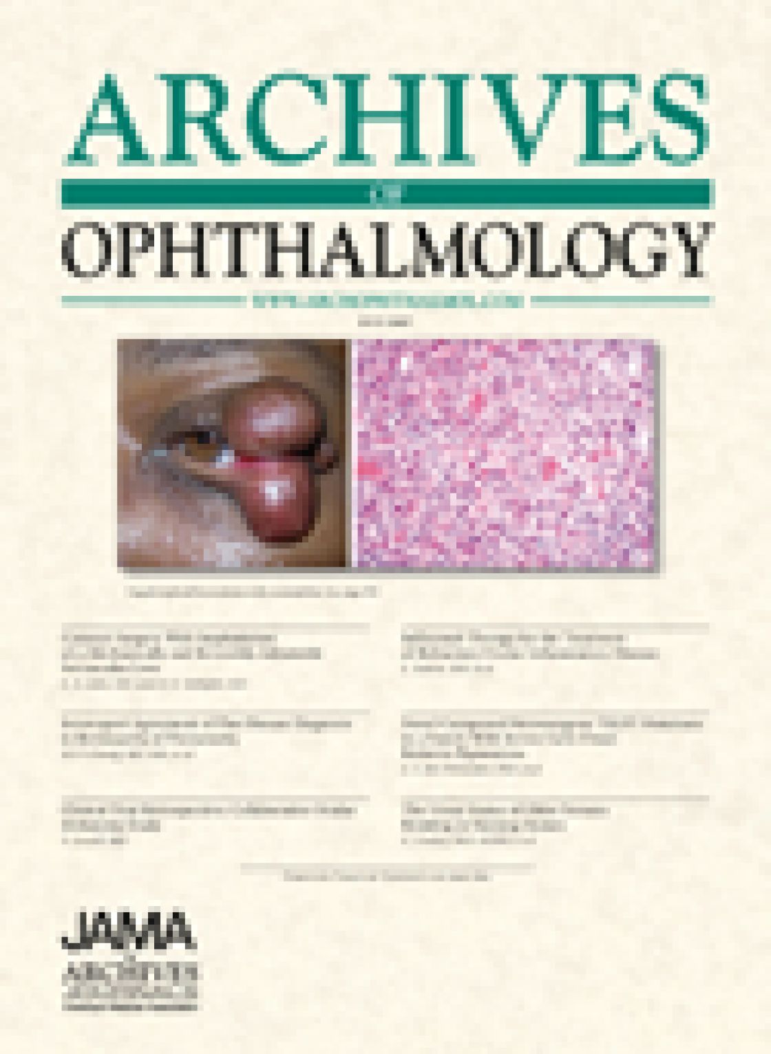 The effect of scan diameter on retinal nerve fiber layer thickness measurements using Stratus Optical Coherence Tomography