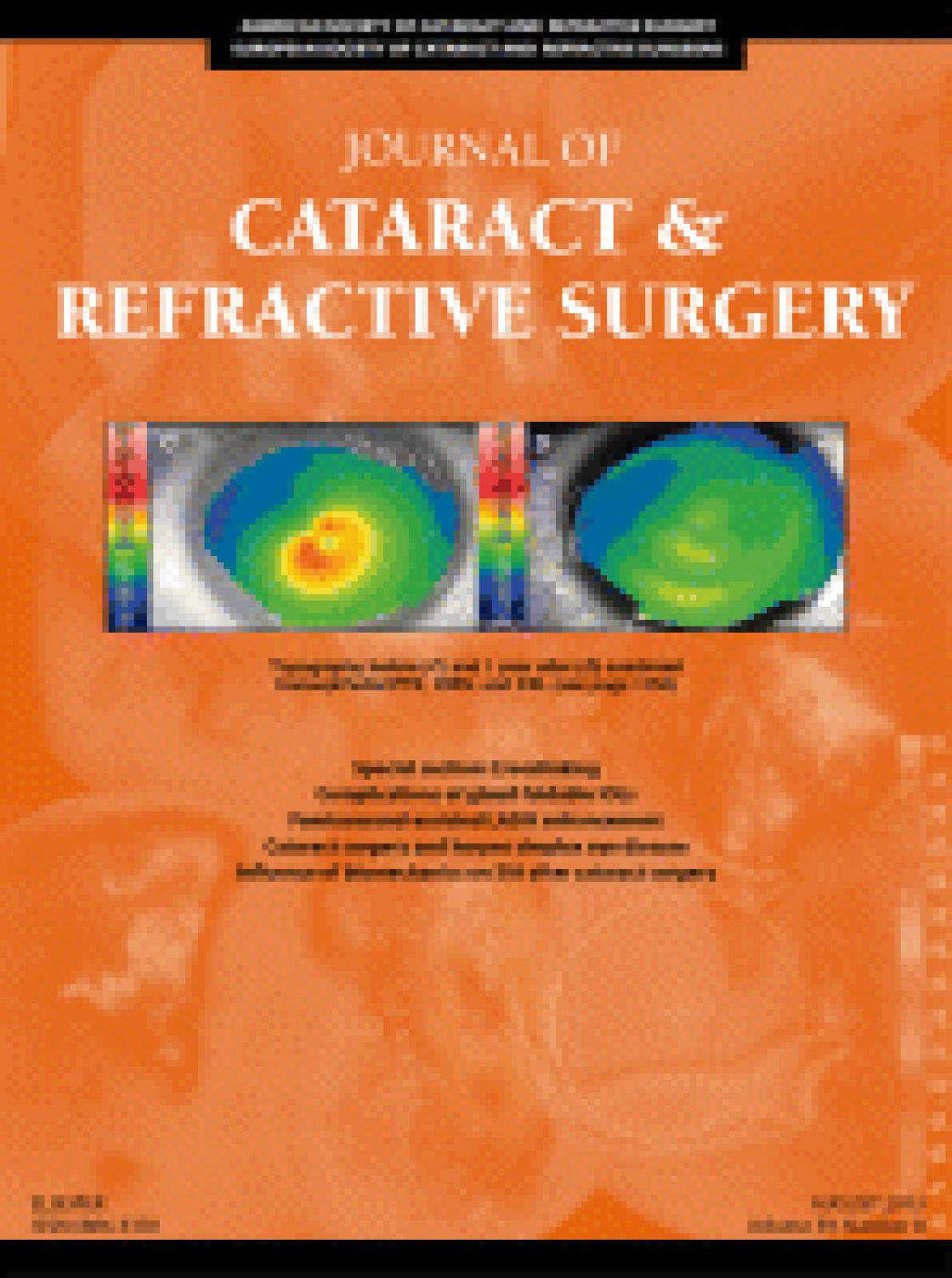 Intraocular lens power calculation with the Scheimpflug camera after refractive surgery
