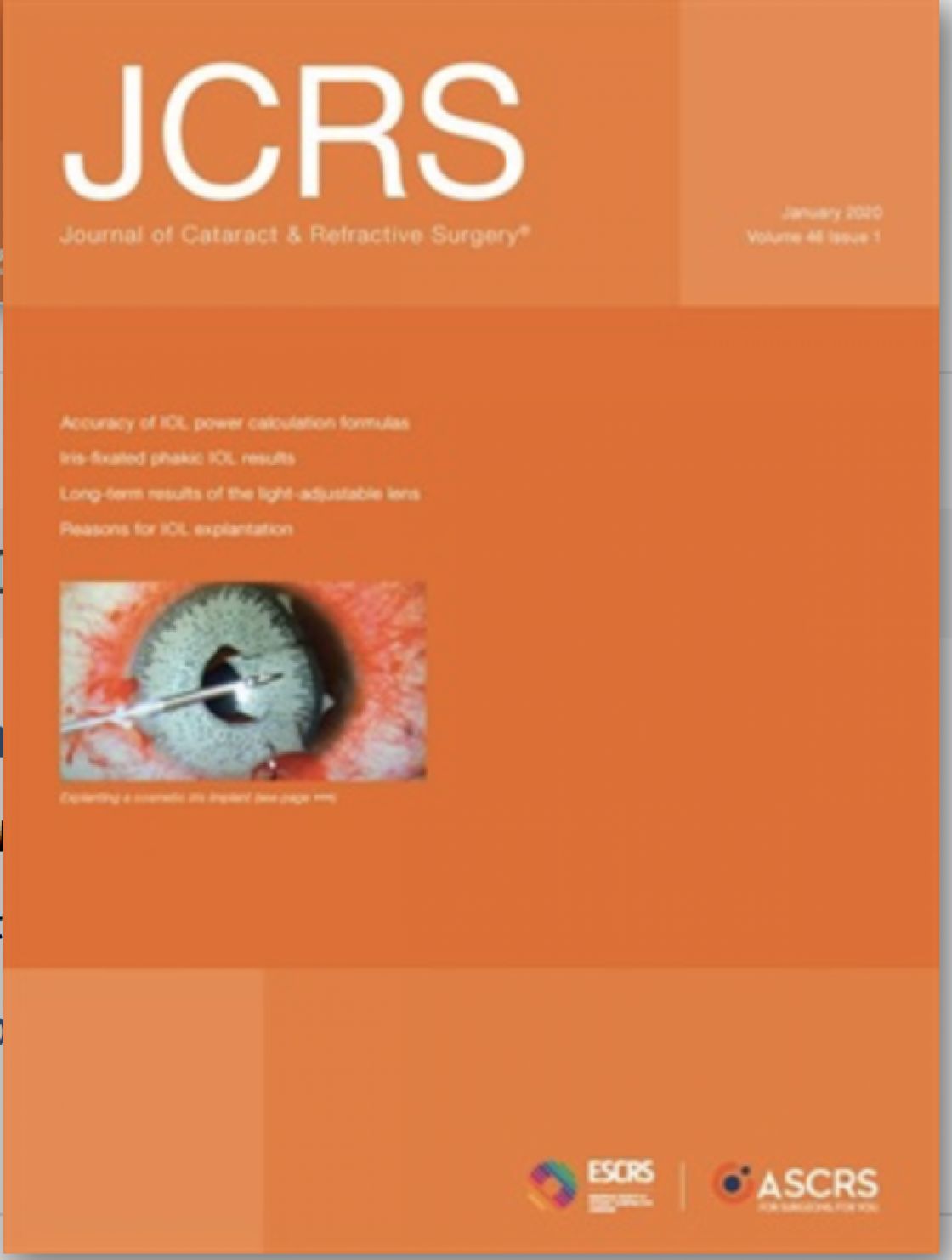 Measurement of central corneal thickness with optical low-coherence reflectometry and ultrasound pachymetry in normal and post-femtosecond laser in situ keratomileusis eyes