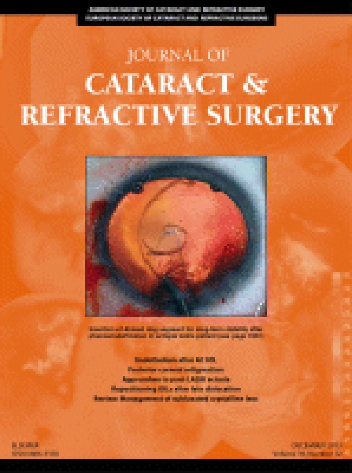 The influence of axial length and corneal power on the astigmatic power of toric intraocular lenses