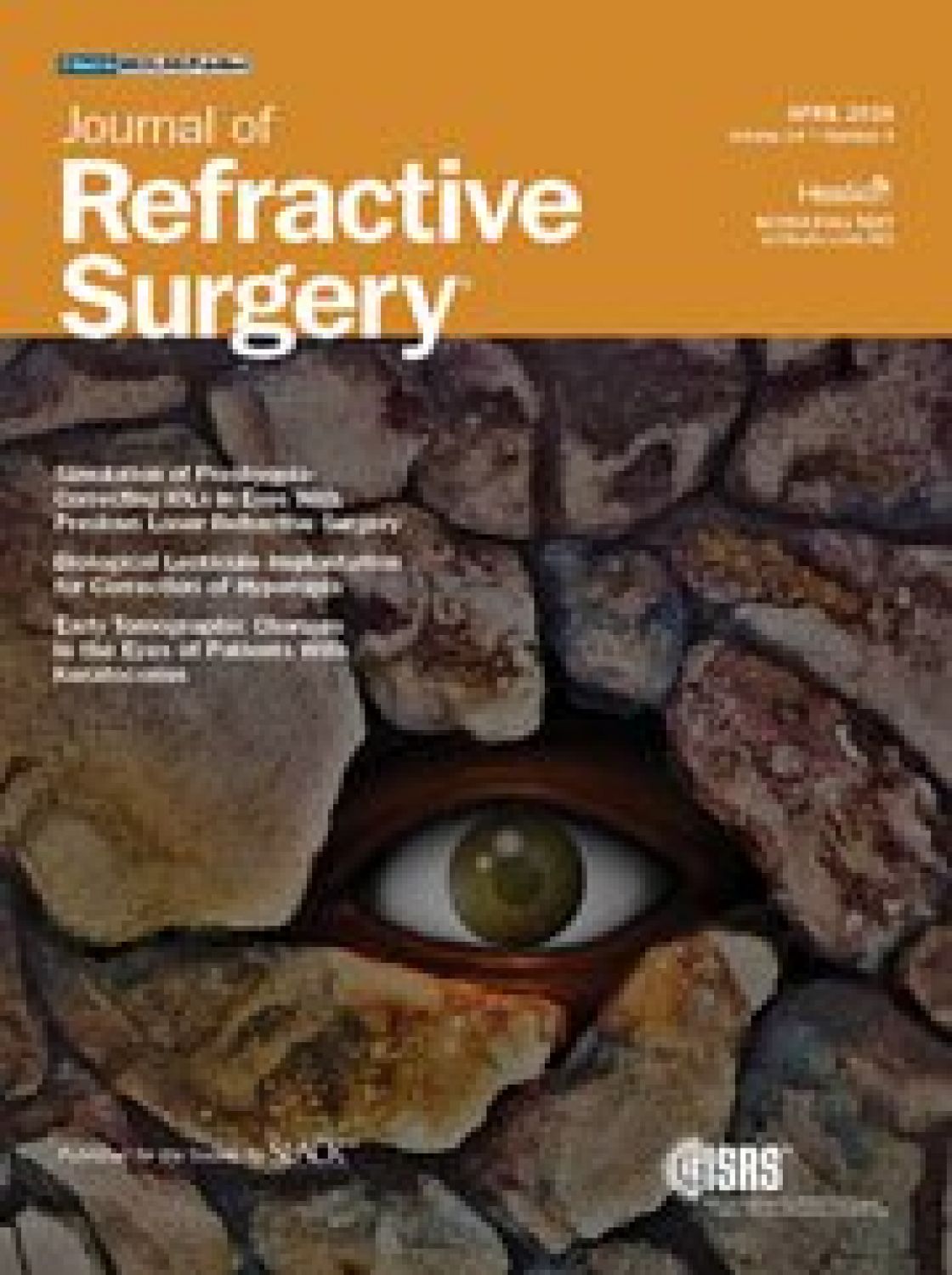 Measurement of central corneal thickness with optical low-coherence reflectometry and ultrasound pachymetry in normal and post-femtosecond laser in situ keratomileusis eyes