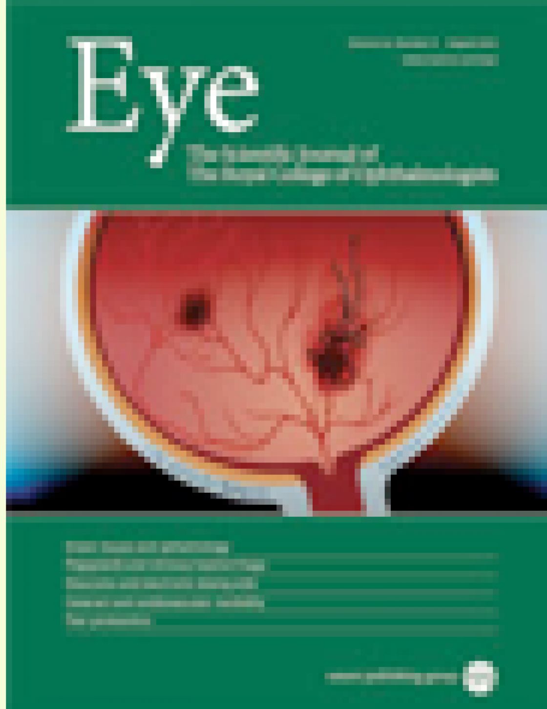 The effect of pupil dilation on retinal nerve fiber layer thickness measurements and their repeatability with Cirrus HD-OCT