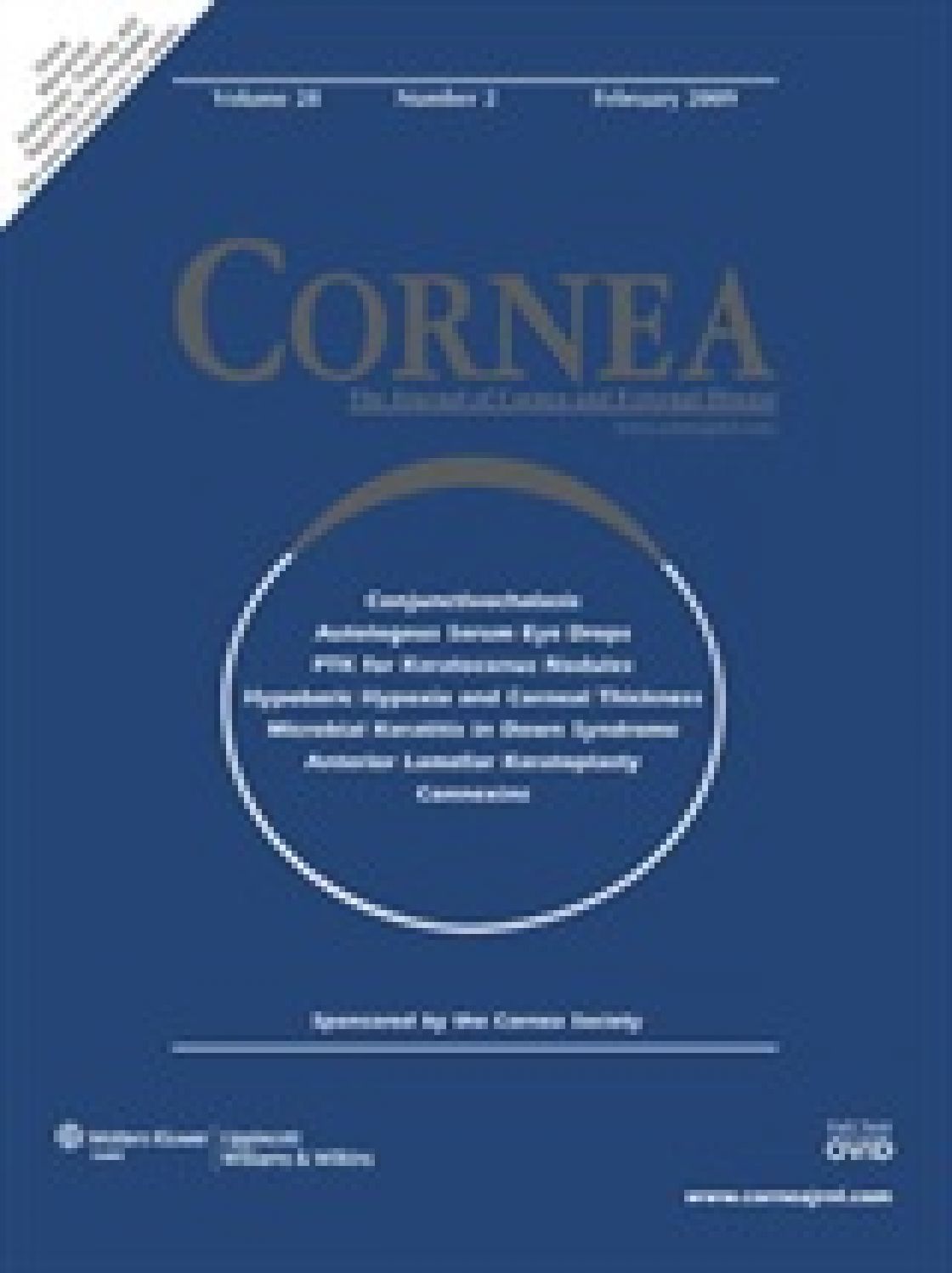 Agreement between Stratus and Visante optical coherence tomography systems in tear meniscus measurements