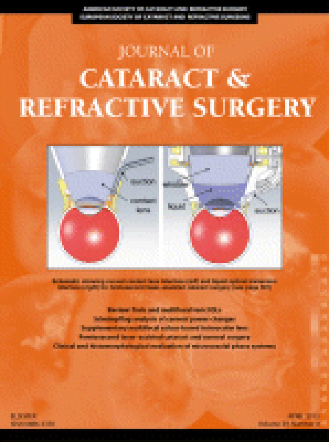 Scheimpflug analysis of corneal power changes after myopic excimer laser surgery