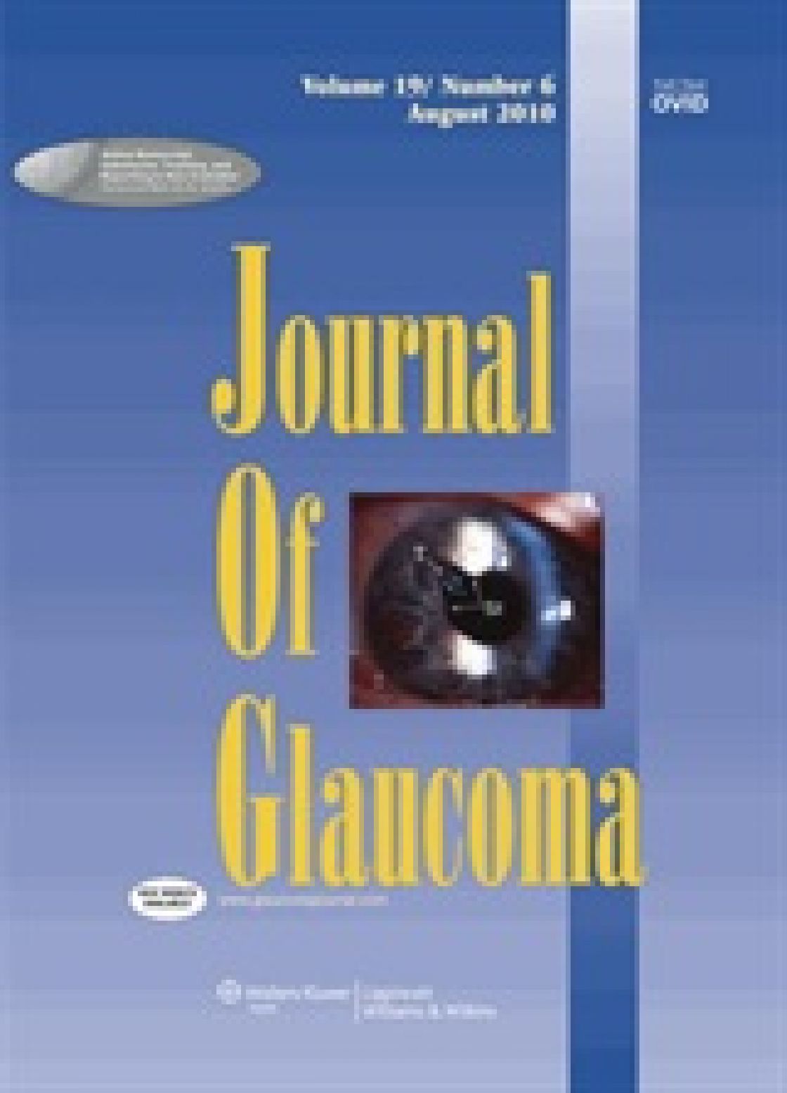 Retinal nerve fiber layer thickness measurements by Fourier-domain optical coherence tomography: a comparison between Cirrus HD-OCT and RTVue in healthy eyes