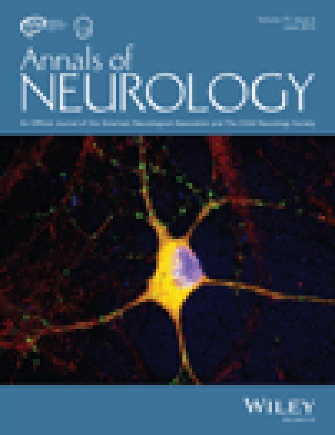 Measurement of central corneal thickness with optical low-coherence reflectometry and ultrasound pachymetry in normal and post-femtosecond laser in situ keratomileusis eyes