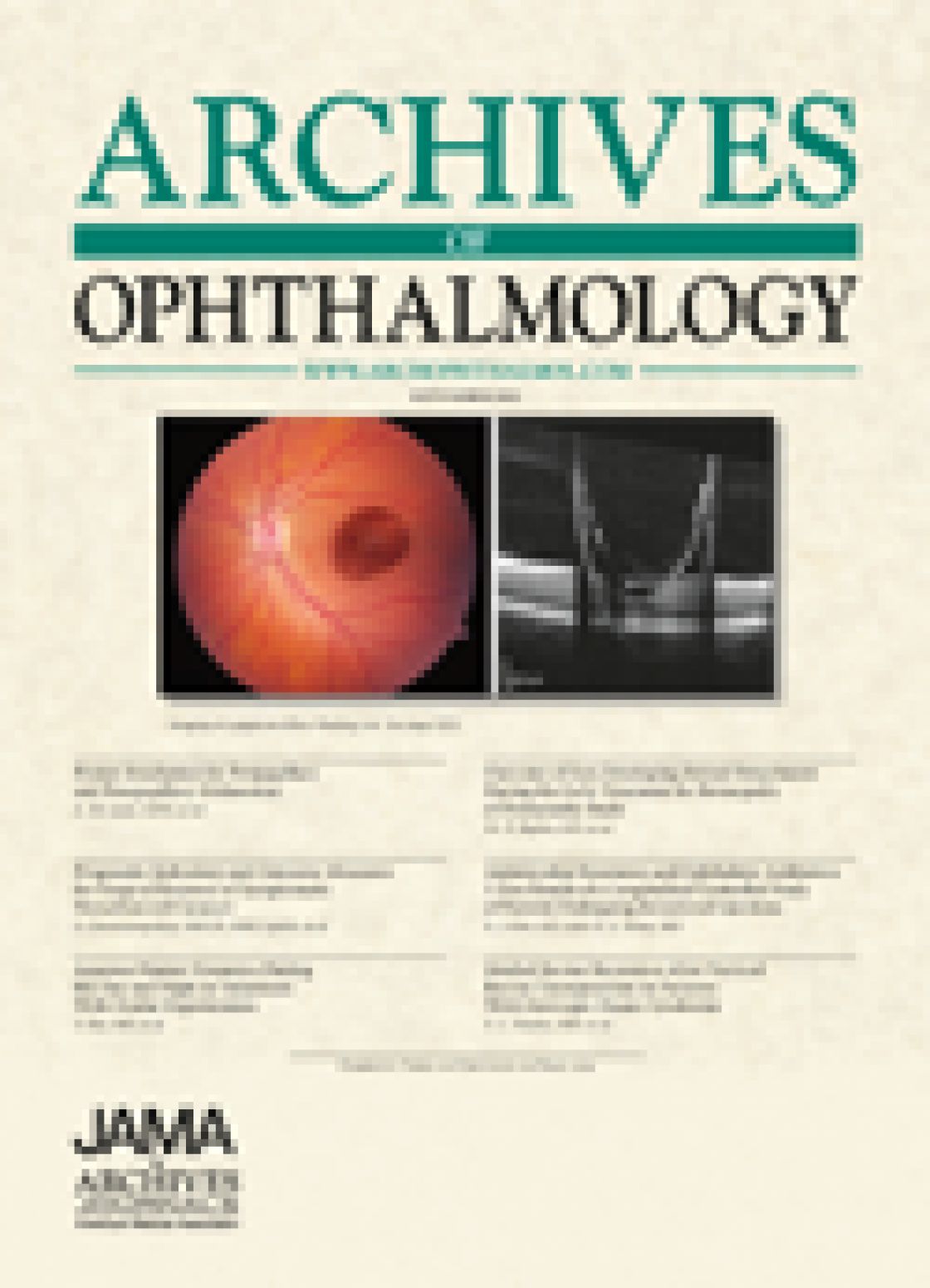 Optical coherence tomography for optic disc edema