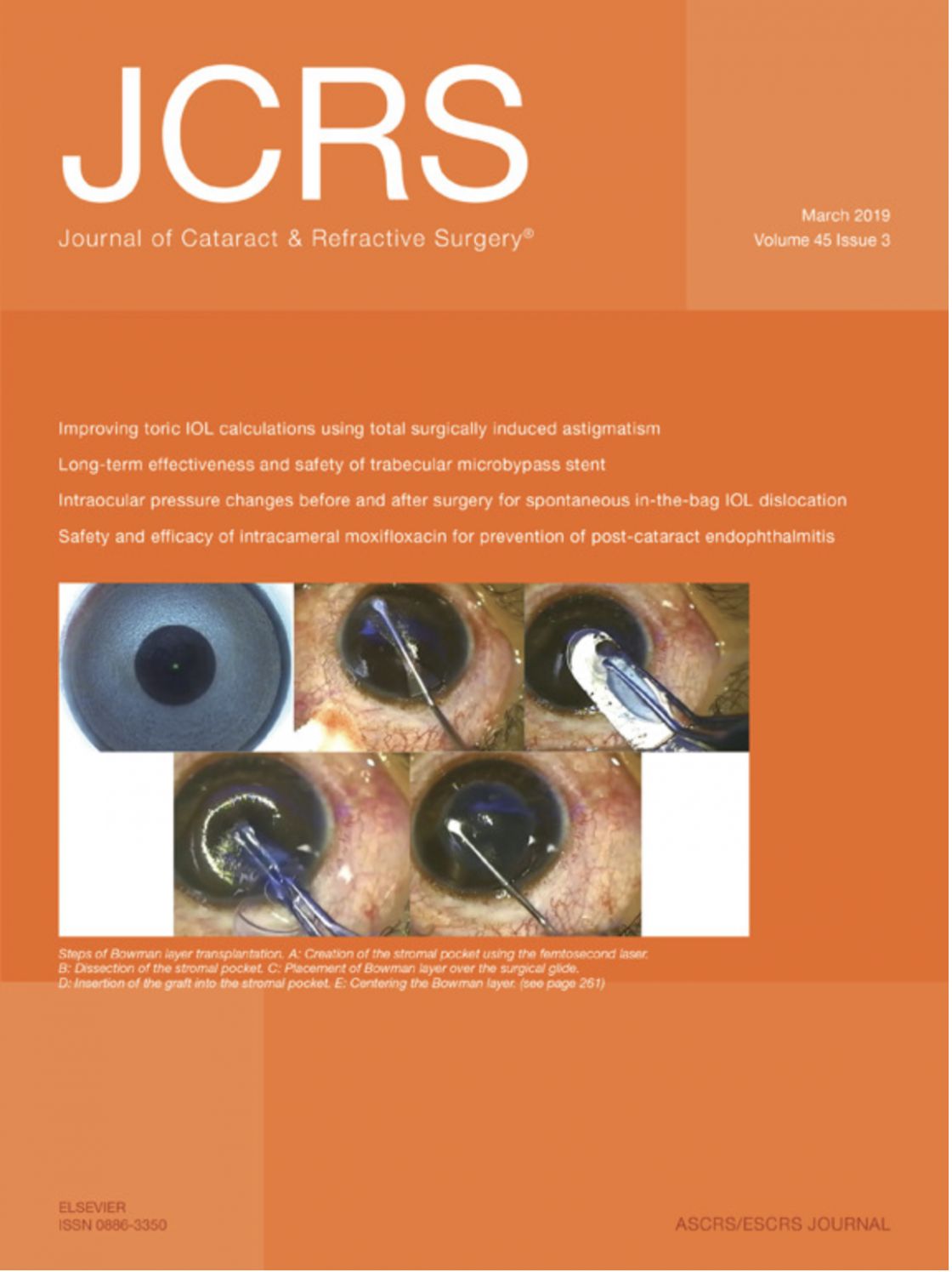 Measurement of central corneal thickness with optical low-coherence reflectometry and ultrasound pachymetry in normal and post-femtosecond laser in situ keratomileusis eyes