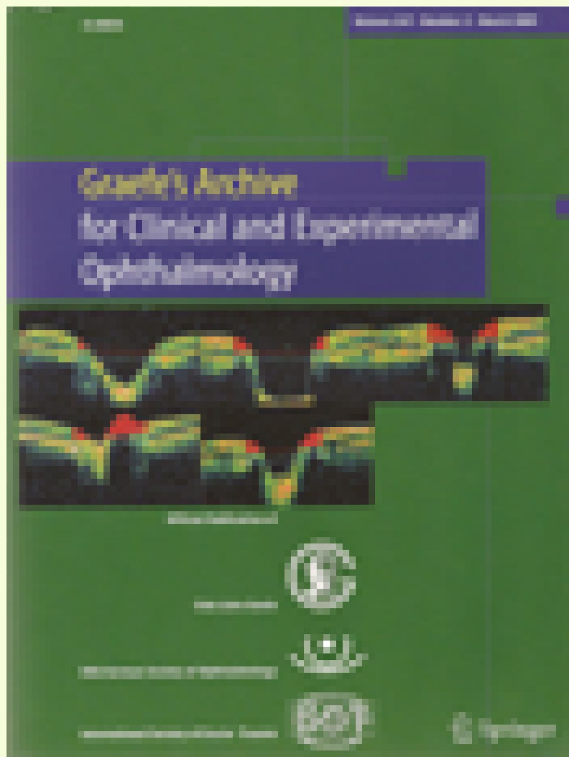 Agreement between optical coherence tomography and digital stereophotography in vertical cup-to-disc ratio measurement