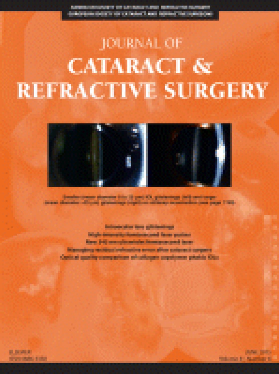 Measurement of central corneal thickness with optical low-coherence reflectometry and ultrasound pachymetry in normal and post-femtosecond laser in situ keratomileusis eyes