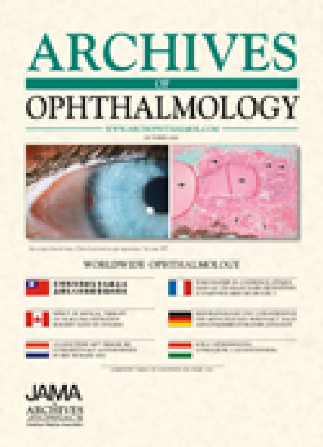 Optic nerve structure in healthy subjects