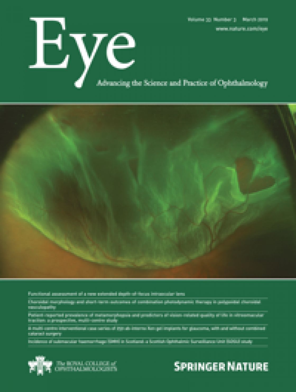 Measurement of central corneal thickness with optical low-coherence reflectometry and ultrasound pachymetry in normal and post-femtosecond laser in situ keratomileusis eyes