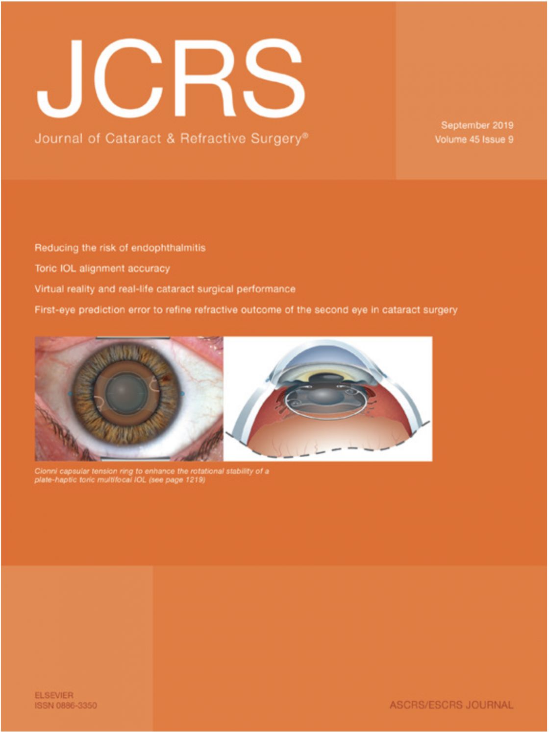 Measurement of central corneal thickness with optical low-coherence reflectometry and ultrasound pachymetry in normal and post-femtosecond laser in situ keratomileusis eyes