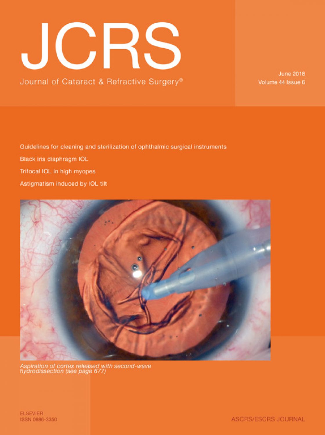 Measurement of central corneal thickness with optical low-coherence reflectometry and ultrasound pachymetry in normal and post-femtosecond laser in situ keratomileusis eyes