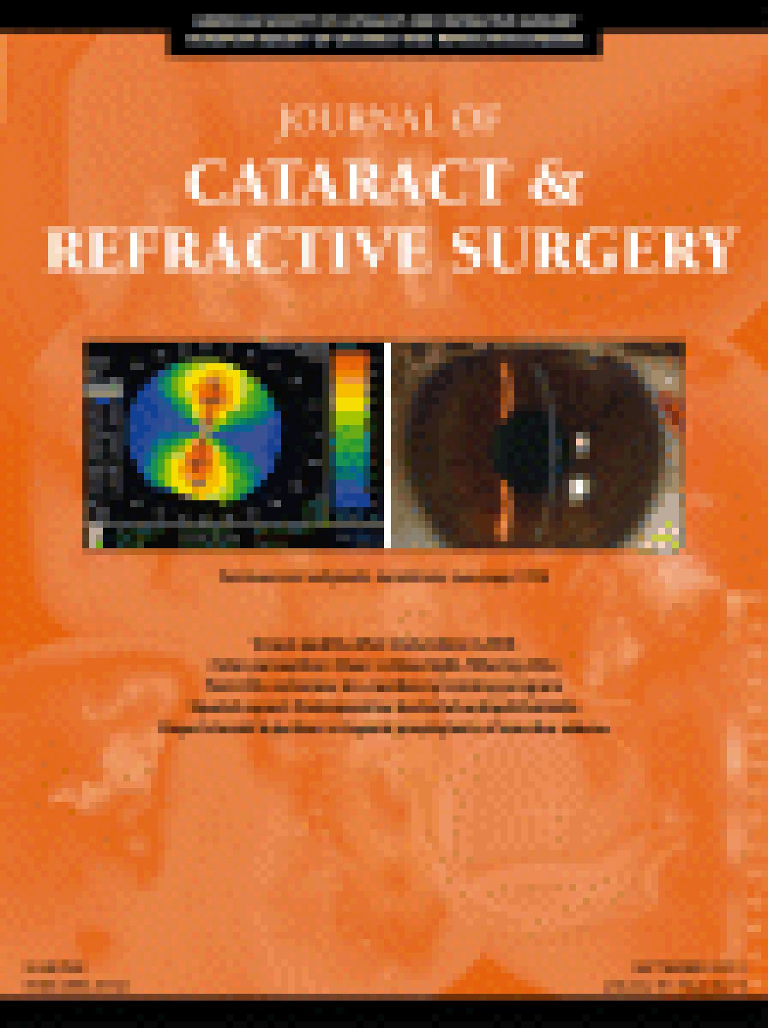 Comparison of anterior segment measurements by three Scheimpflug tomographers and 1 Placido corneal topographer.