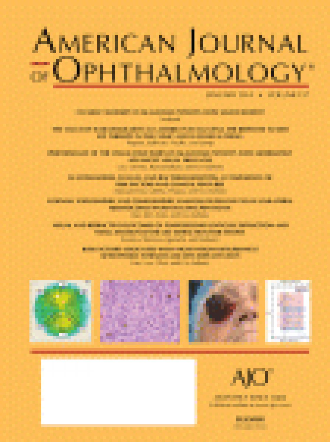 Intraocular lens power calculation by ray-tracing after myopic excimer laser surgery