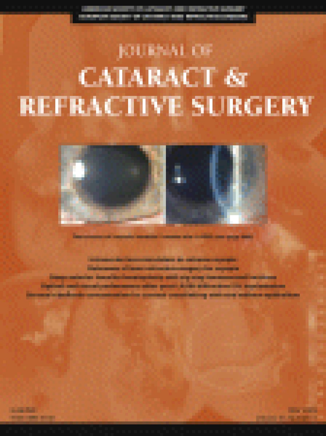 Diffractive intraocular lens power after myopic laser in situ keratomileusis