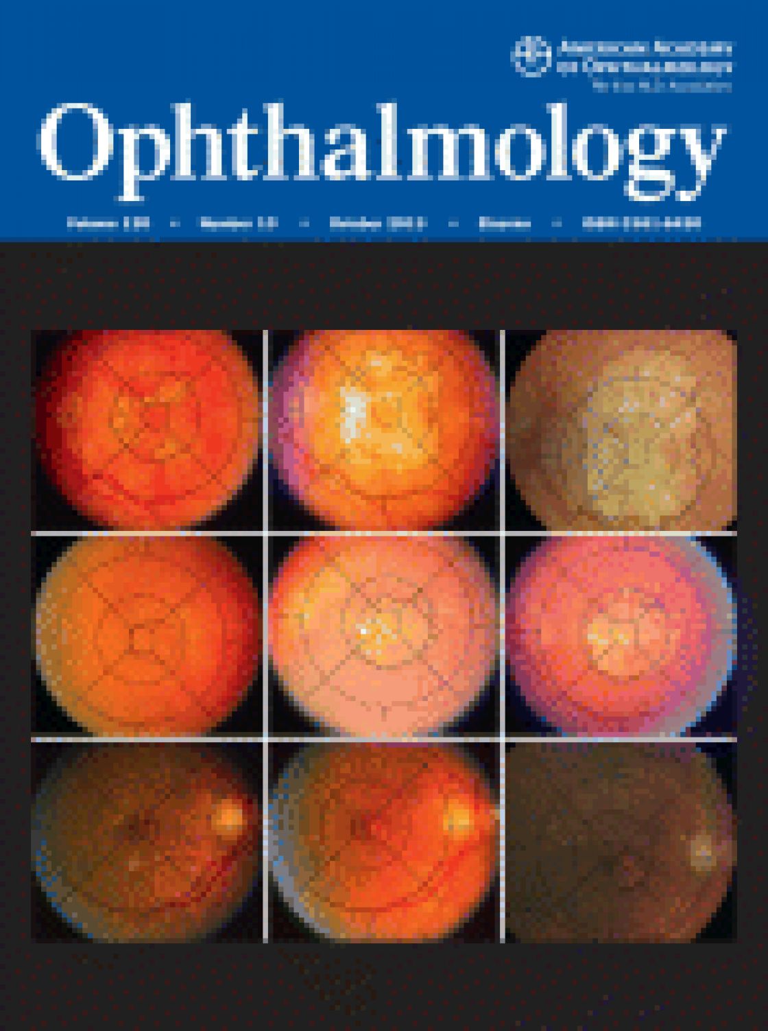 A comparison between Scheimpflug imaging and optical coherence tomography in measuring corneal thickness