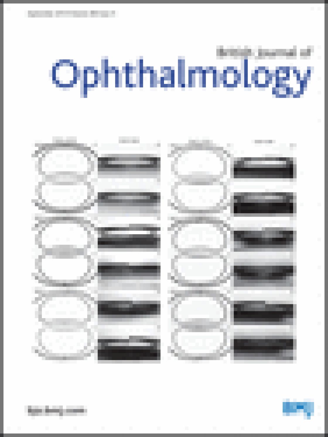 Evaluation of a new optical biometry device for measurement of ocular components and its comparison with IOLMaster