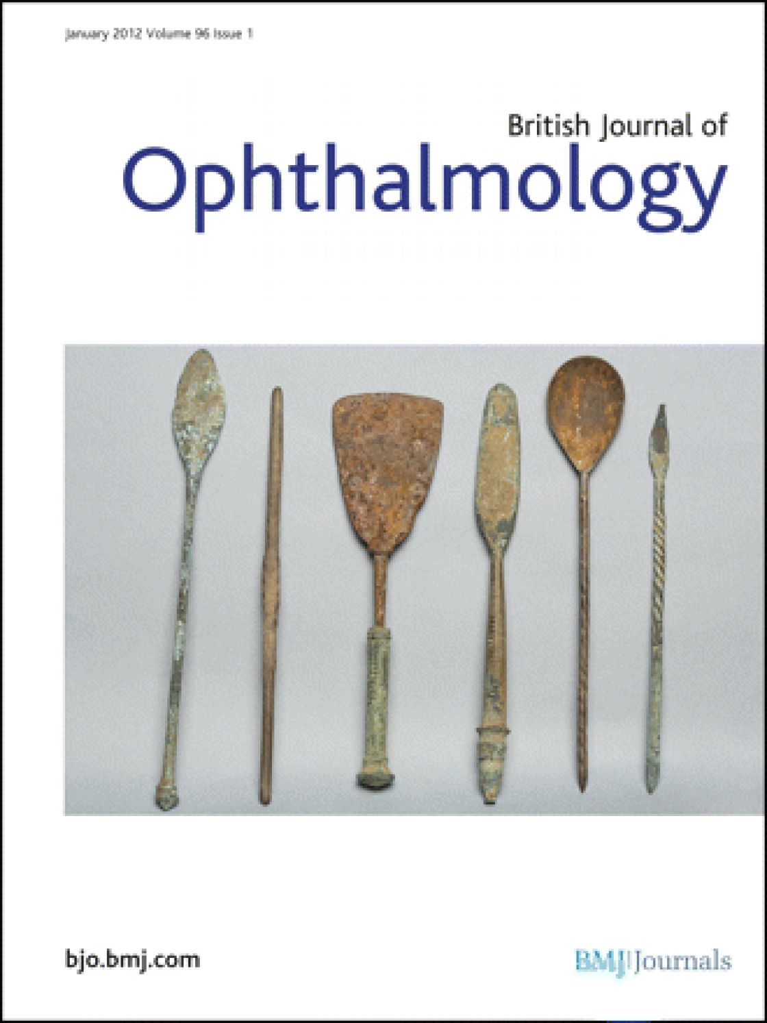 The influence of axial length on retinal nerve fibre layer thickness and optic-disc size measurements by spectral-domain OCT