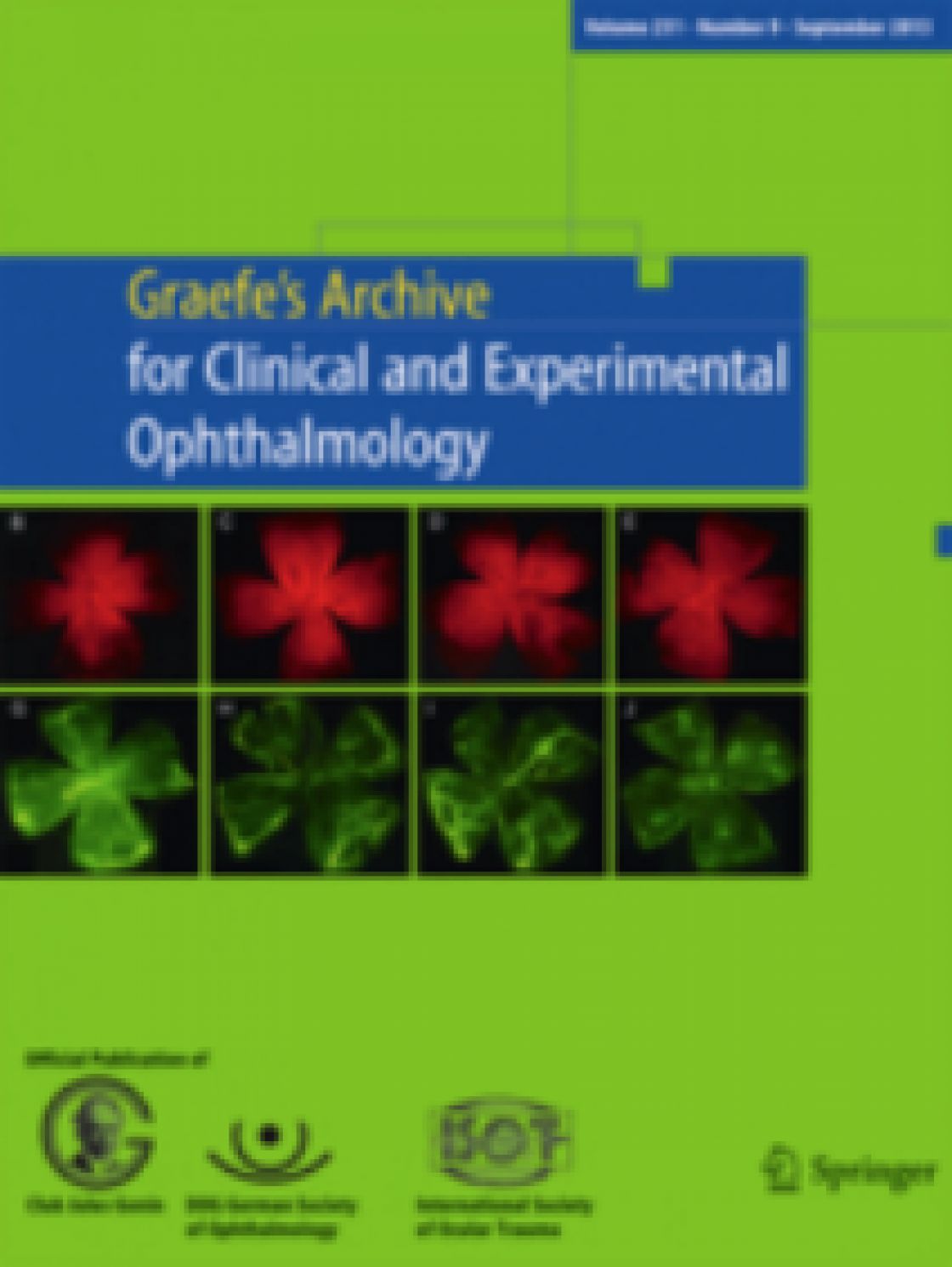 Measurement of central corneal thickness with optical low-coherence reflectometry and ultrasound pachymetry in normal and post-femtosecond laser in situ keratomileusis eyes