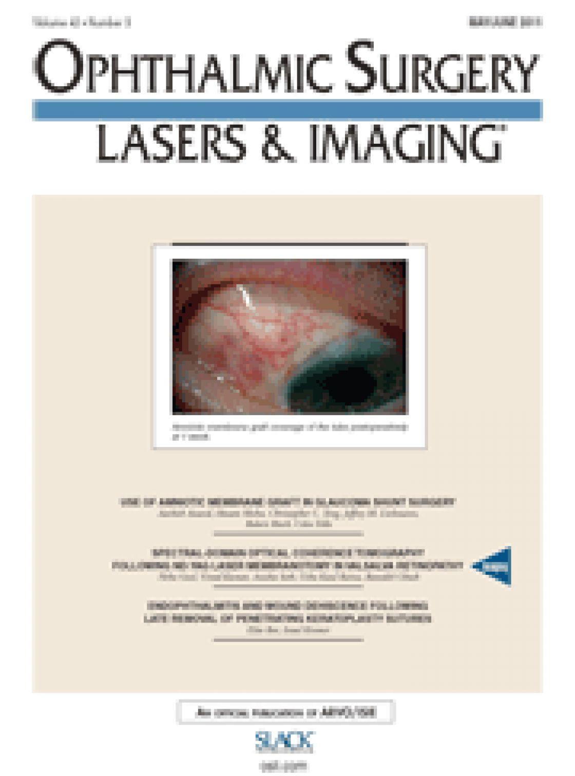 Repeatability of optic nerve head parameters measured by spectral-domain OCT in healthy eyes