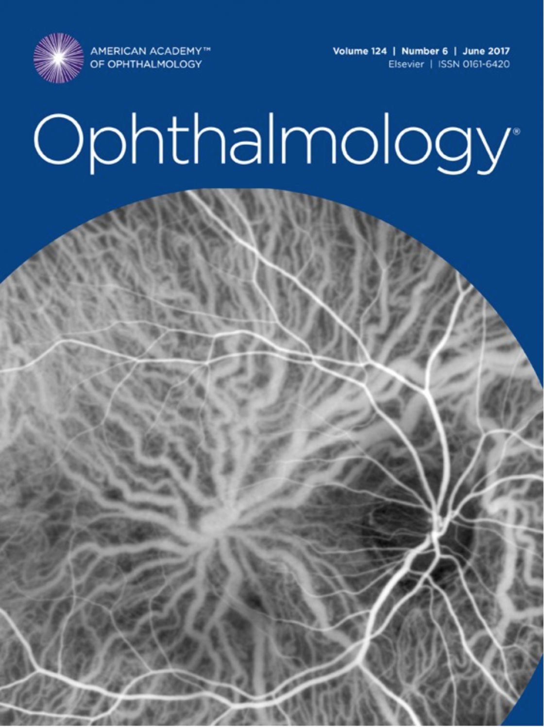 Measurement of central corneal thickness with optical low-coherence reflectometry and ultrasound pachymetry in normal and post-femtosecond laser in situ keratomileusis eyes