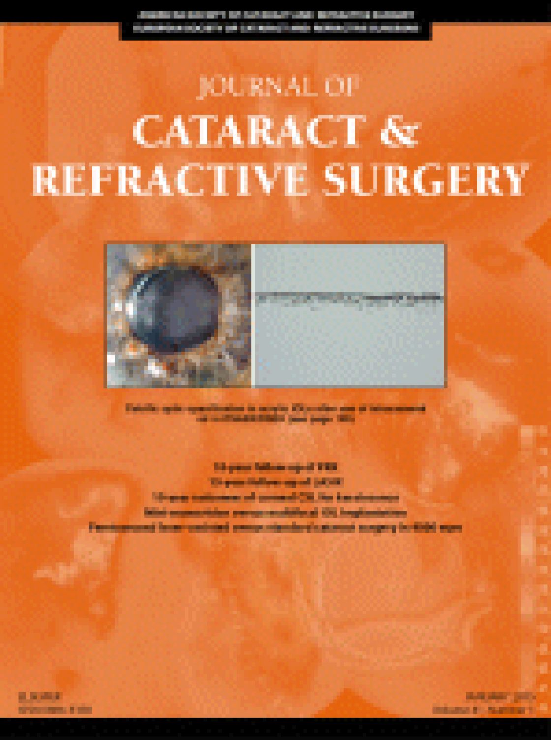 Comparison of anterior segment measurements with Scheimpflug/Placido photography-based topography system and IOLMaster partial coherence interferometry in patients with cataracts.