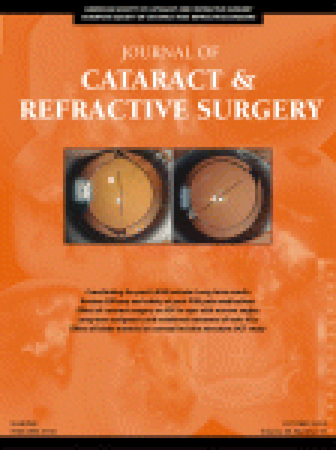 Influence of posterior corneal astigmatism on total corneal astigmatism in eyes with moderate-to-high astigmatism