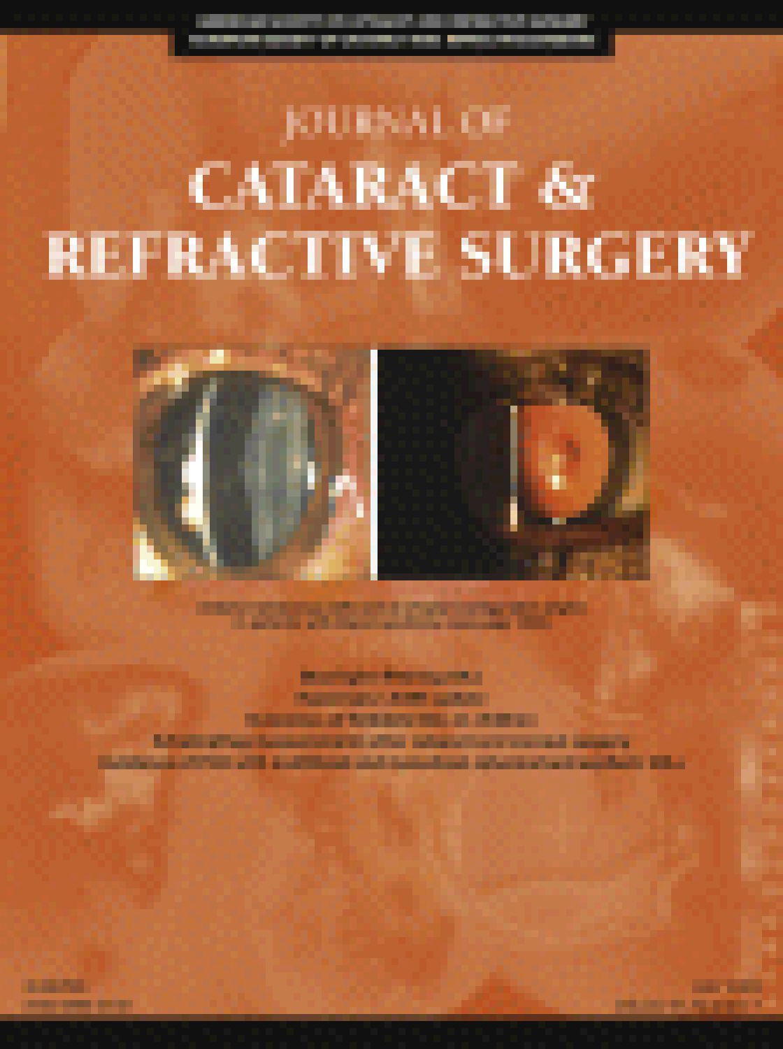 Accuracy of Scheimpflug corneal power measurements for intraocular lens power calculation