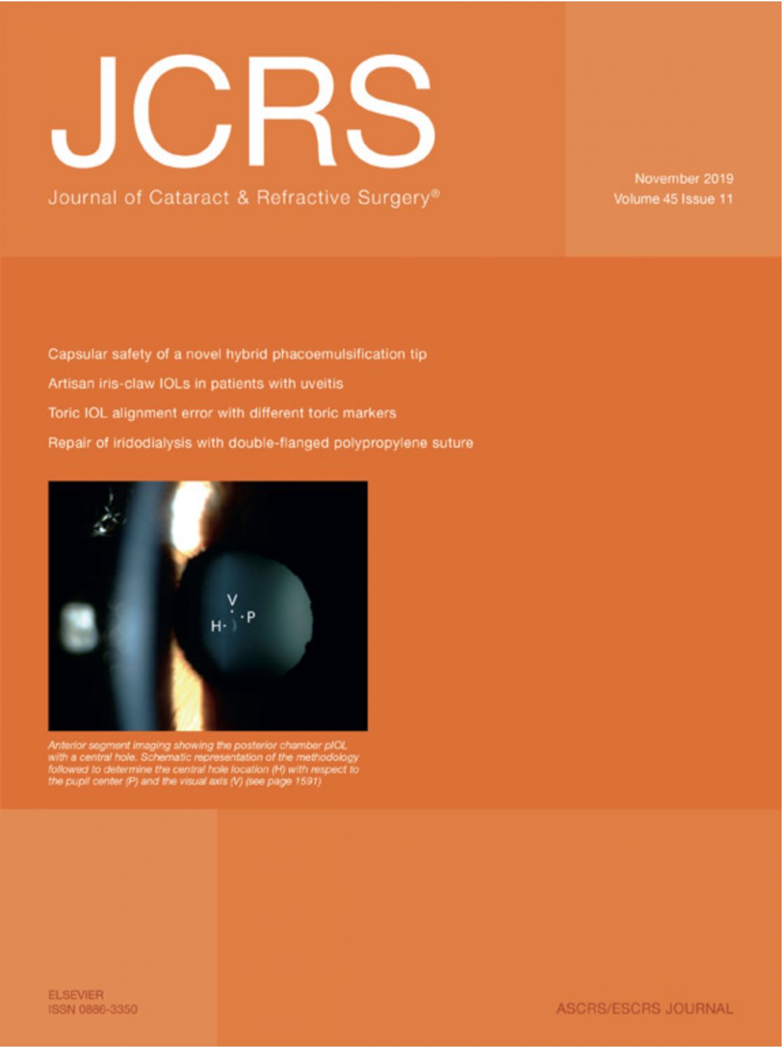 Measurement of central corneal thickness with optical low-coherence reflectometry and ultrasound pachymetry in normal and post-femtosecond laser in situ keratomileusis eyes