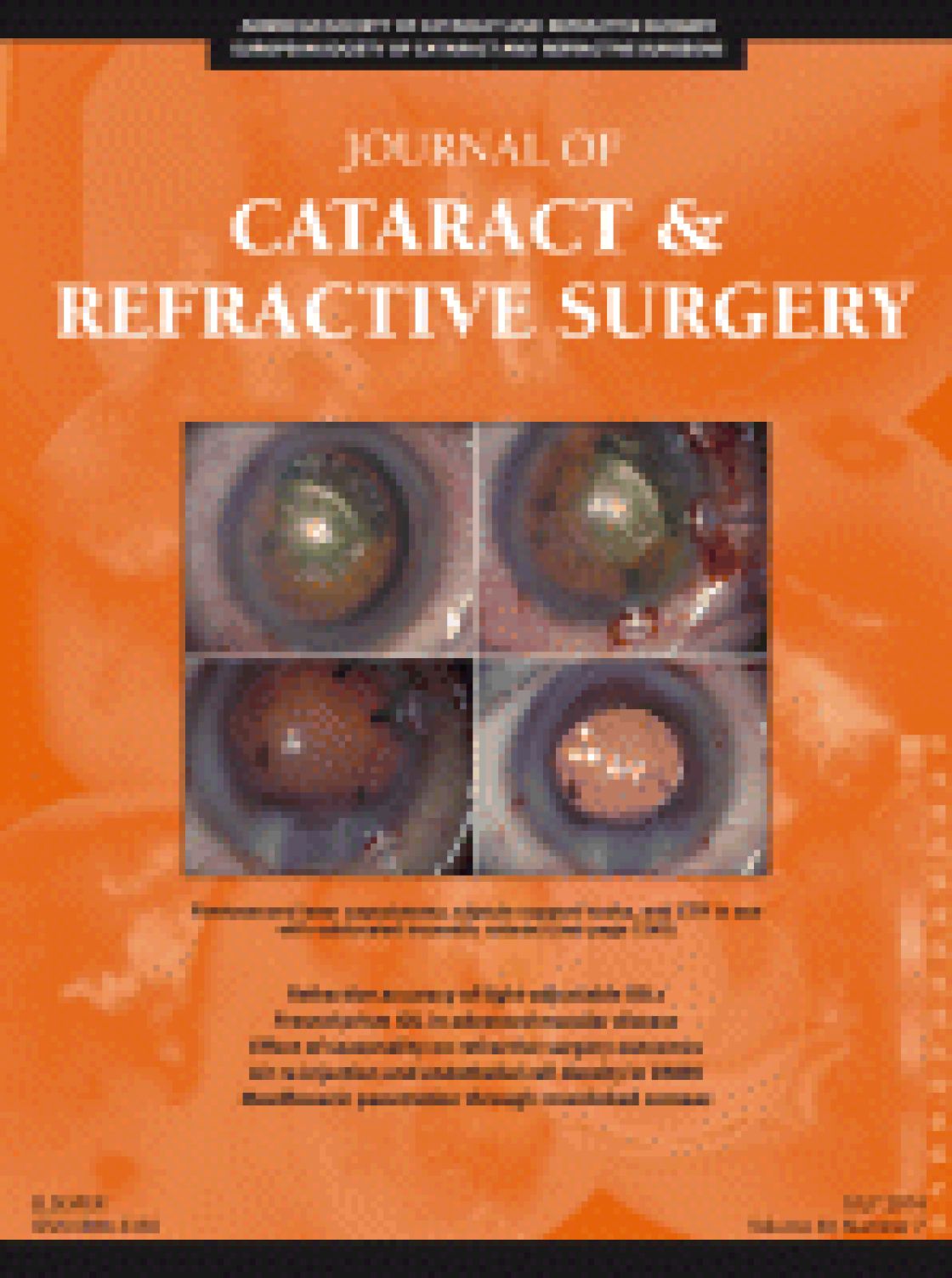 Corneal ray-tracing versus simulated keratometry for estimating corneal power changes after excimer laser surgery
