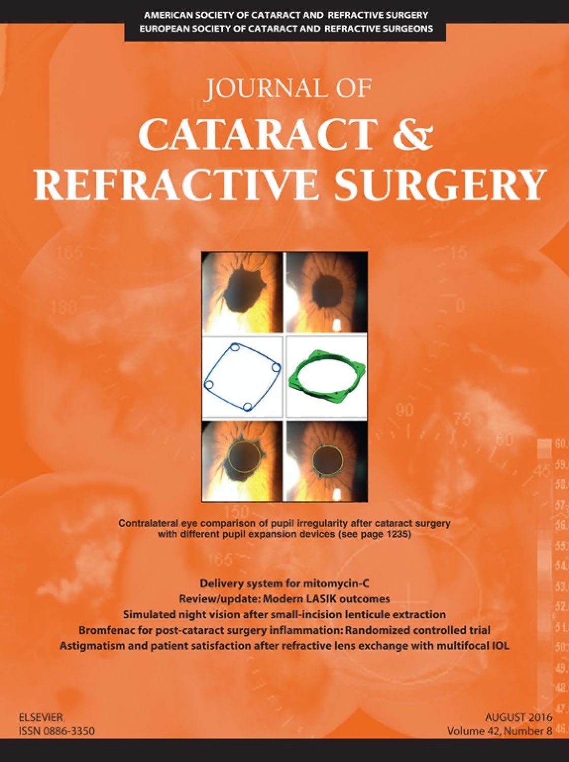 Measurement of central corneal thickness with optical low-coherence reflectometry and ultrasound pachymetry in normal and post-femtosecond laser in situ keratomileusis eyes