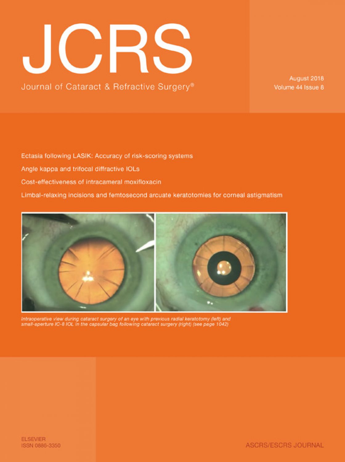 Measurement of central corneal thickness with optical low-coherence reflectometry and ultrasound pachymetry in normal and post-femtosecond laser in situ keratomileusis eyes